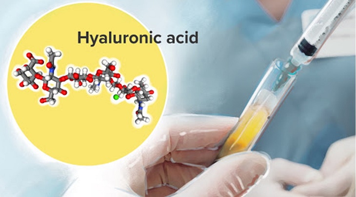Axit hyaluronic giống như chất nhờn bôi trơn khớp có trong cơ thể, được dùng cho cả trường hợp bị viêm