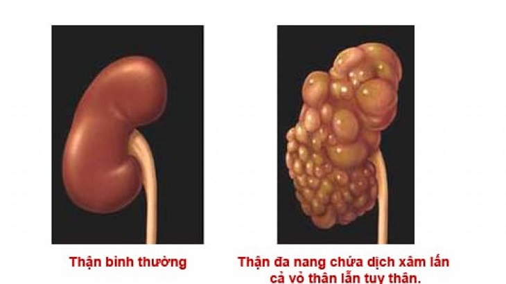 nang than uong thuoc gi