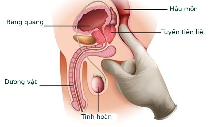 thuoc tri viem tuyen tien liet