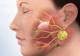 Bệnh viêm khớp thái dương hàm: Nguyên nhân và cách chữa