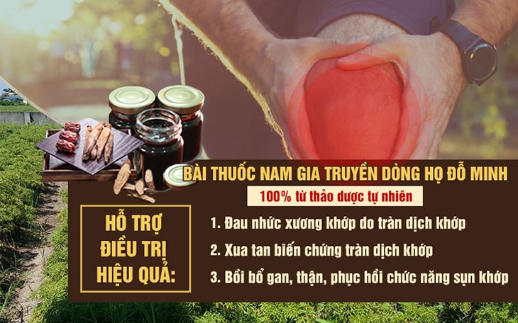 thuoc dong y tri dau khop goi