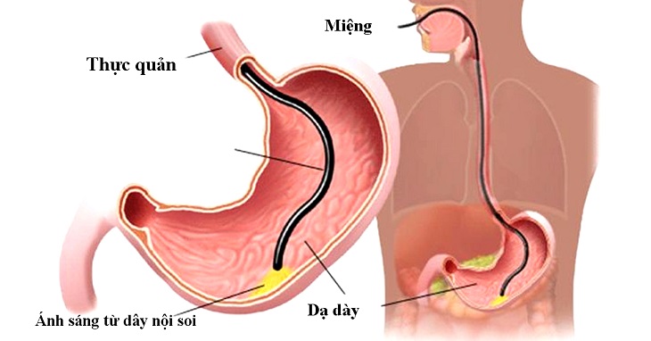 noi soi da day khong dau