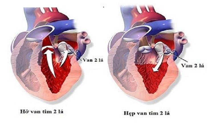 ho van 2 la