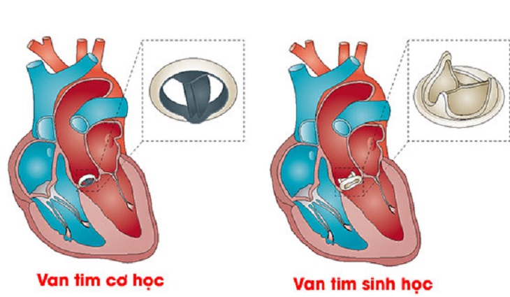 ho van 2 la