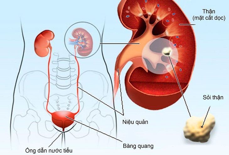 tieu buot dau bung duoi