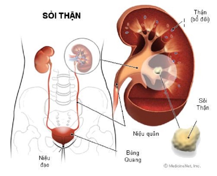 soi nieu quan