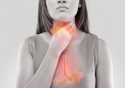 Viêm họng do trào ngược dạ dày thực quản là nguyên nhân phổ biến, nhiều người bệnh gặp phải