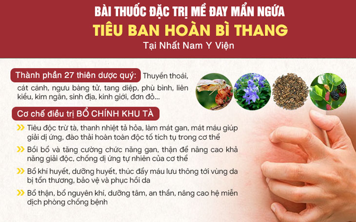 Thành phần và công dụng bài thuốc Tiêu Ban Hoàn Bì Thang đặc trị mề đay