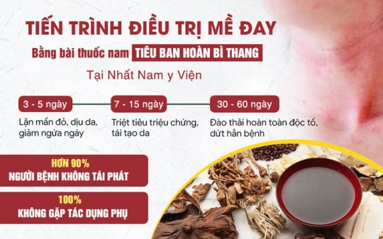 Phác đồ điều trị mề đay giúp người bệnh cảm nhận rõ hiệu quả theo từng giai đoạn