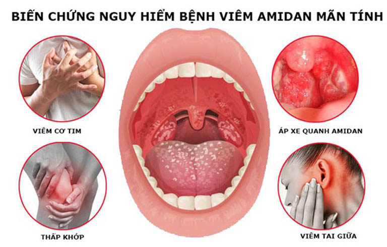 Bệnh có thể gây ra nhiều biến chứng nguy hiểm