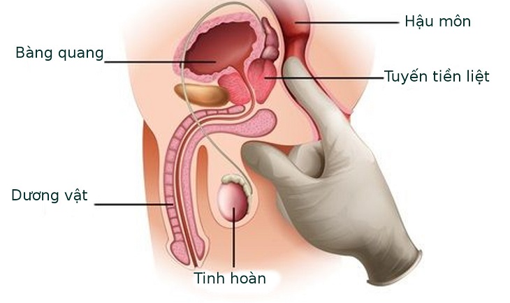 benh phi dai tien liet tuyen o nguoi gia