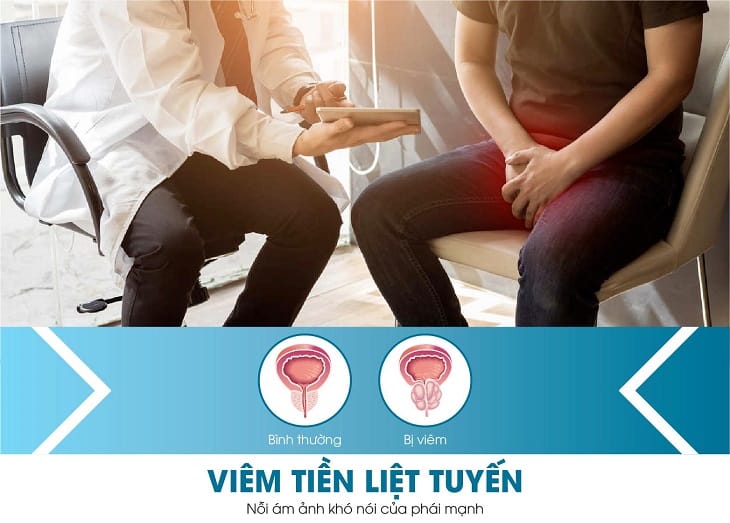 xet nghiem viem tuyen tien liet