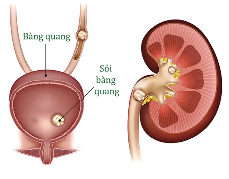 voi hoa tien liet tuyen