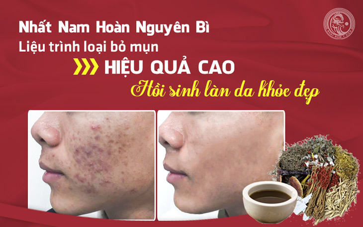 Khác hàng Hà Minh Tuấn cải thiện làm da mụn do rối loạn nội tiết tuổi dậy thì