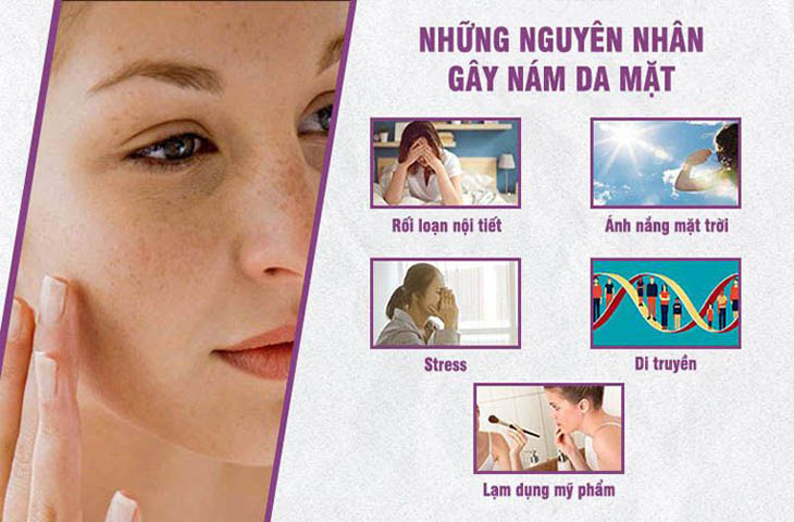 Một số nguyên nhân gây nám tàn nhang