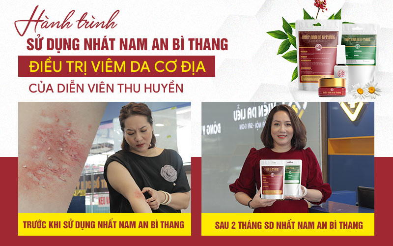 Nghệ sĩ Thu Huyền trị viêm da cơ địa thành công sau 2 tháng dùng Nhất Nam An Bì Thang