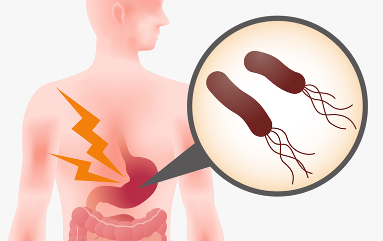 Nhất Nam Bình Vị Khang dùng được cho người bệnh bị viêm loét dạ dày do vi khuẩn hp