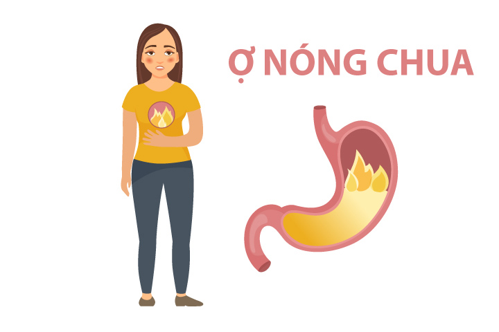 Nhất Nam Bình Vị Khang giúp chấm dứt tình trạng ợ hơi ợ chua