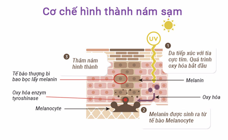 Da tiếp xúc với ánh nắng mặt trời trong thời gian dài là yếu tố chính gây nên sạm nám