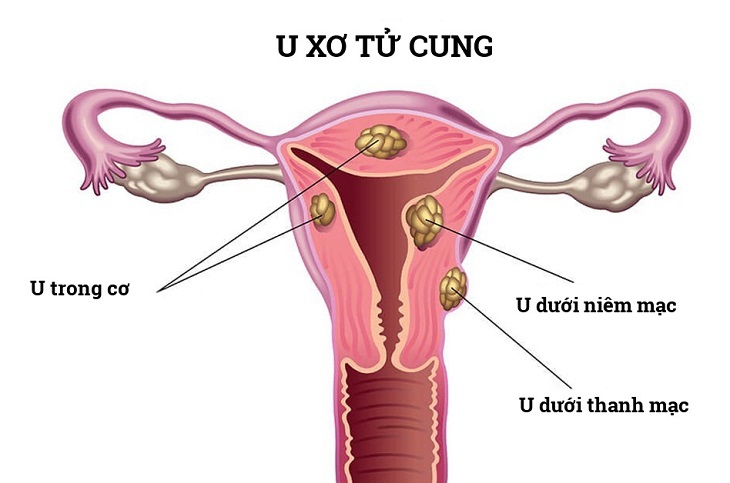 kinh nguyet khong deu