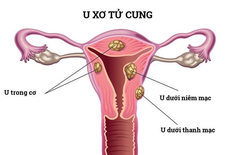 huyet trang co mau hong nhat