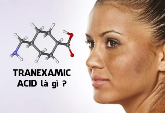 tranexamic acid