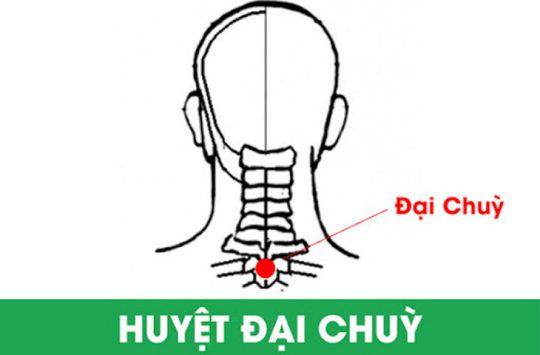 Huyệt Đại Chùy nằm ở chỗ lõm ngay đầu mỏm gai của đốt sống cổ số 7