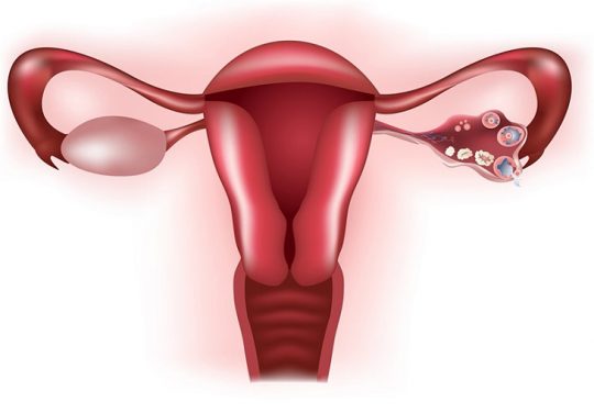 Phụ Nữ Bị Tắc Vòi Trứng Có Làm IVF Được Không? Quy Trình