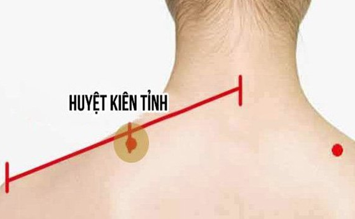 Huyệt Kiên Tỉnh là một trong 36 huyệt đạo quan trọng trên cơ thể con người