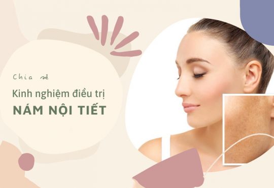 7 Cách Điều Trị Nám Nội Tiết Tại Nhà Cho Hiệu Quả Bất Ngờ