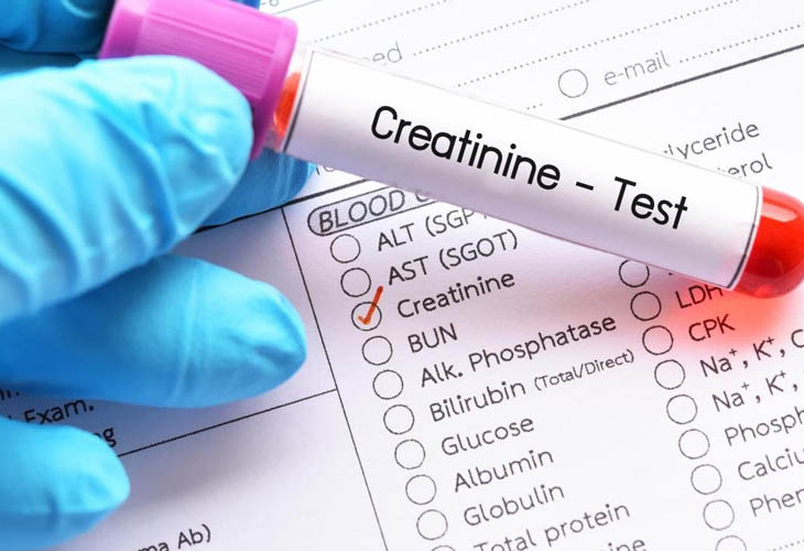 Chỉ số Creatinine huyết thanh