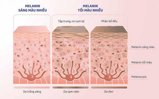 ỨC CHẾ SẢN SINH SẮC TỐ MELANIN