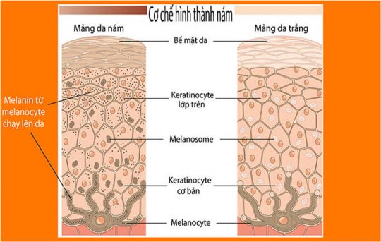 ỨC CHẾ SẢN SINH SẮC TỐ MELANIN