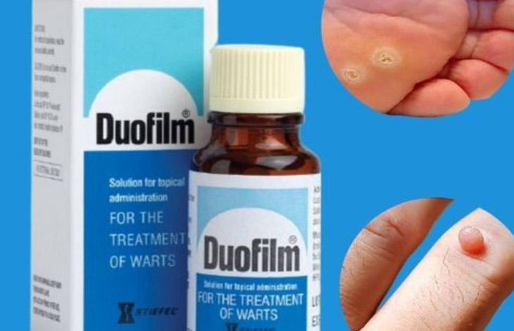 Duofilm 15ml được điều chế ở dạng dung dịch dễ sử dụng