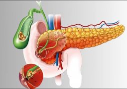 Ung thư đường mật: Do viêm đường mật nhiều lần, kéo dài, người bệnh bị sút cân, vàng da