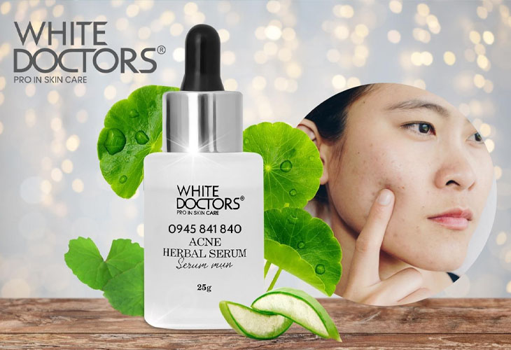 Serum trị mụn cho da dầu White Doctors Acne Herbal Acne cho hiệu quả tốt