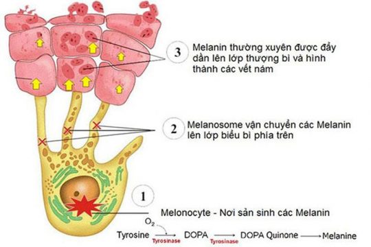 ỨC CHẾ QUÁ TRÌNH SẢN SINH SẮC TỐ MELANIN