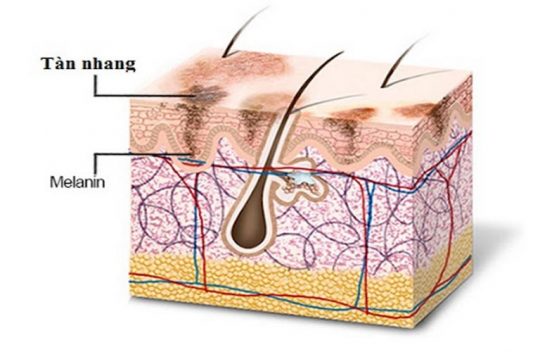 ỨC CHẾ SẢN SINH SẮC TỐ MELANIN