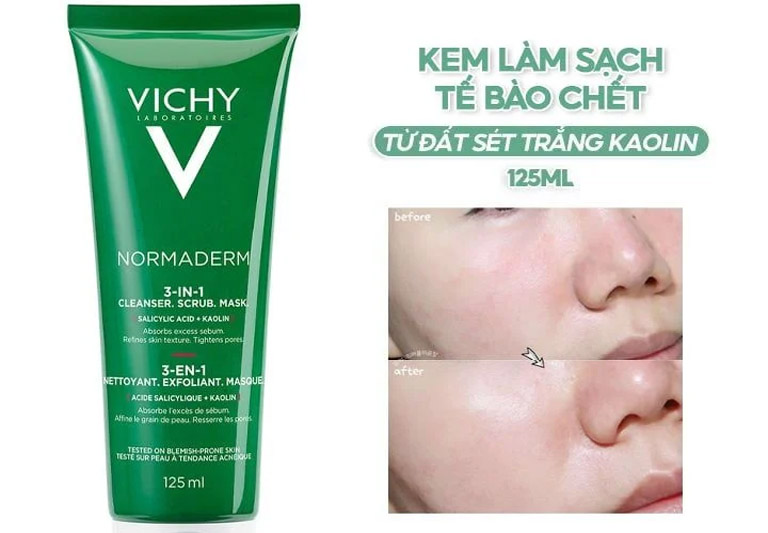 Vichy Normaderm 3 in 1 Scrub là sản phẩm tẩy tế bào chết chuyên biệt cho da dầu mụn