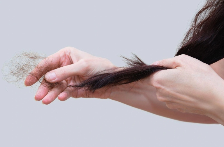 Rụng tóc cần điều trị từ căn nguyên để ngăn ngừa nguy cơ tái phát