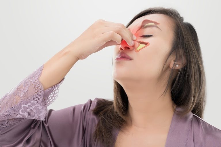 Bài thuốc điều trị viêm xoang của Nam Y Đỗ Minh Đường có thể áp dụng điều trị nhiều thể bệnh khác nhau