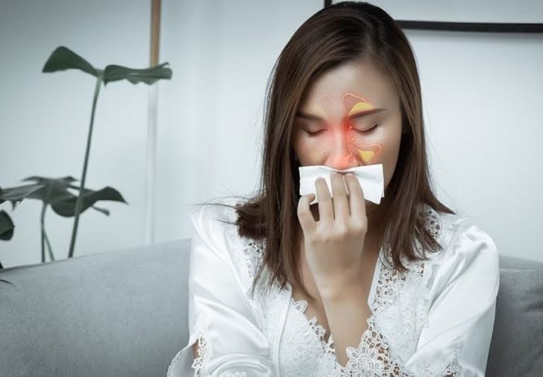 Viêm xoang khiến nhiều người bệnh khổ sở vì không tìm được phương pháp điều trị hiệu quả